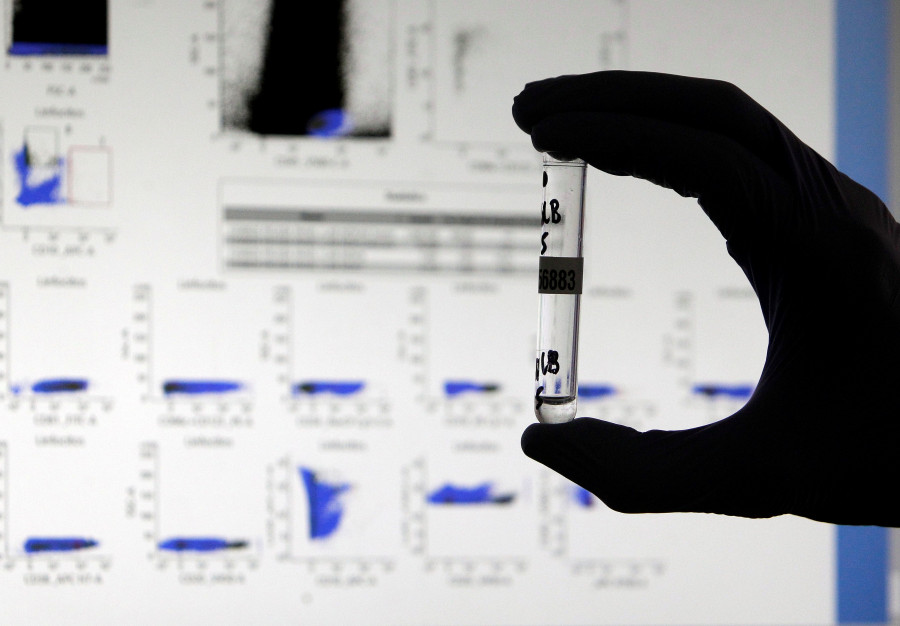 Desarrollan un nuevo test que logra detectar anticuerpos que eran invisibles