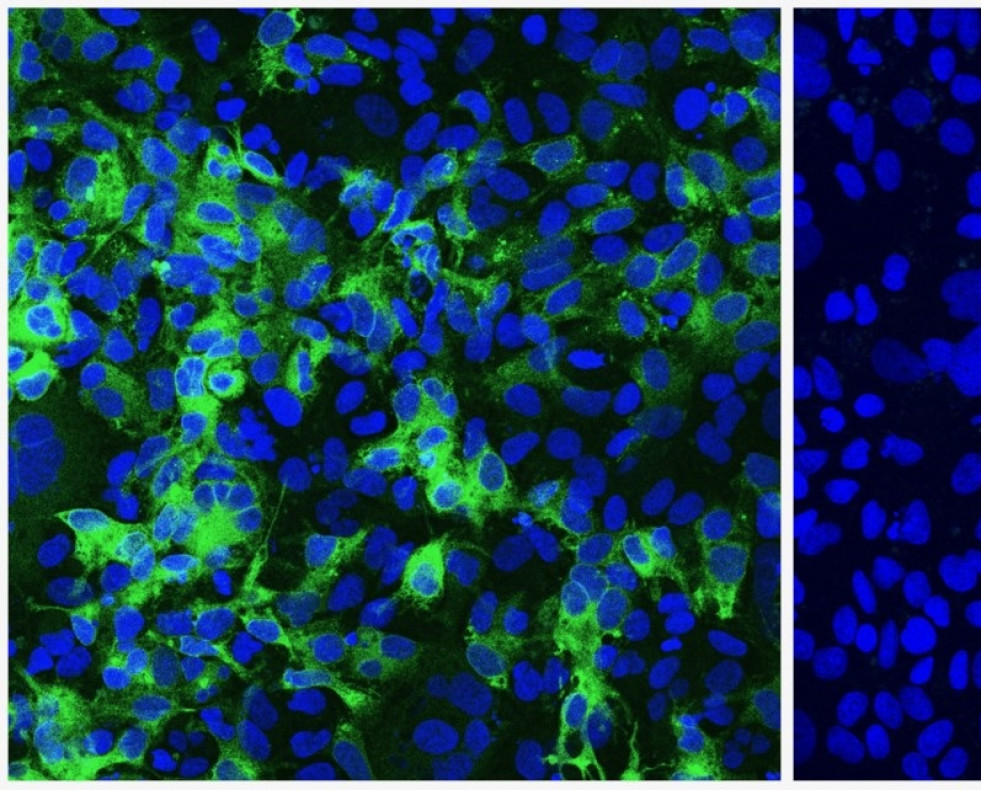 Imagen de las líneas celulares infectadas con el Virus de la hepatitis C