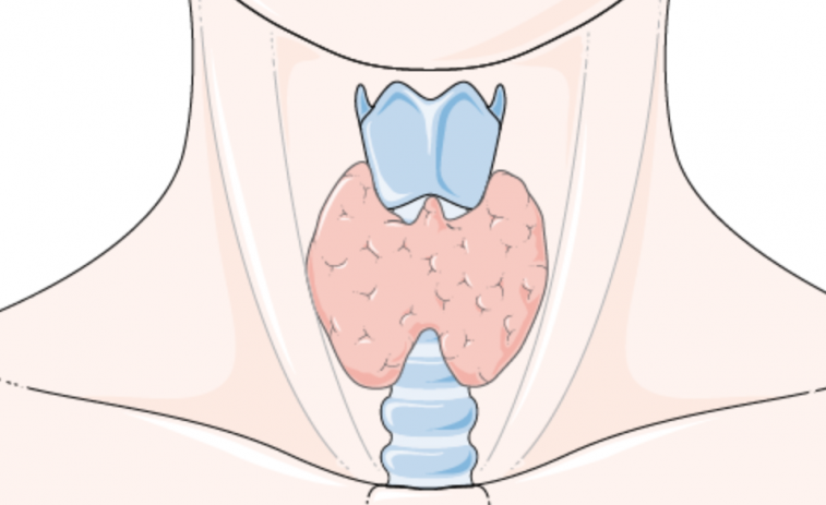 Pacientes con cáncer de tiroides solicitan a Sanidad financiar terapias que mejoran su calidad de vida