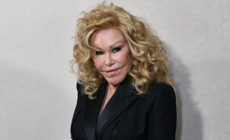 Fallece Jocelyn Wildenstein, famosa por sus extremas cirugías y conocida como 'Catwoman'